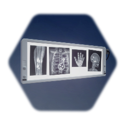 Hospital - Light Box with X-ray Images