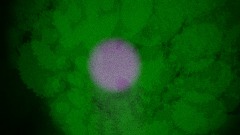 This mess. Epilepsy warning